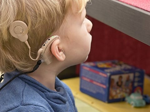 بالفيديو.. مختص: الأولوية القصوى في زراعة القوقعة للأطفال الذين يولدون بضعف سمع حسي عصبي