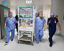 «الربيعة»: أكملنا المرحلة الثالثة من عملية فصل التوأم الطفيلي المصري بنجاح وسنبدأ «الرابعة»