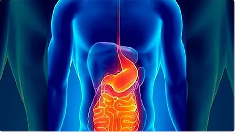 استشاري: 5 مشكلات بالجهاز الهضمي تؤدي إلى نقص الحديد في الجسم