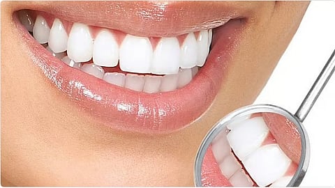 استشاري: أنصح من يضعون تقويم الأسنان بالفحص الدوري لأنهم أكثر عرضة للإصابة بأمراض اللثة