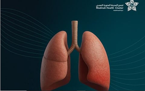 أبرزها السعال والحمى.. أعراض الالتهاب الرئوي والفئات الأكثر عرضة للإصابة