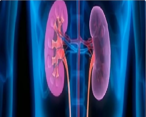 استشاري يوضح أبرز المفاهيم الخاطئة المنتشرة حول صحة الكلى