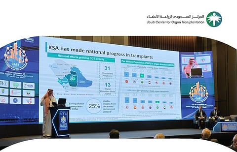 مؤتمر الجمعية الآسيوية لزراعة الأعضاء