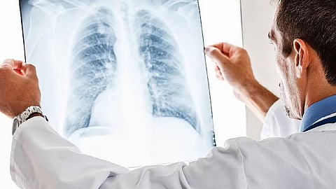 تجمع الرياض الصحي يوضح أهمية الكشف المبكر لمرض السرطان