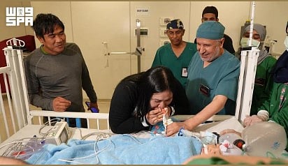في إنجاز طبي جديد.. نجاح عملية فصل التوأم الملتصق الفلبيني بعد 6 ساعات
