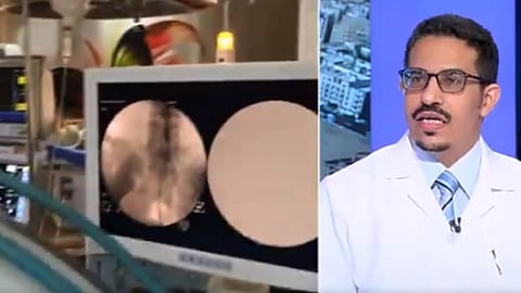 بالفيديو.. استشاري يقدم 4 نصائح للحماية من الانزلاق الغضروفي