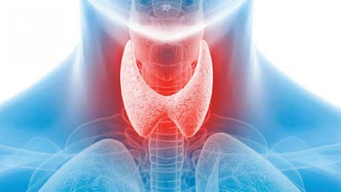 أنواع مشاكل الغدة الدرقية وأعراضها