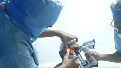 فقد بصره بشظايا مقذوف الحوثي.. إجراء عملية زراعة قرنية ليمني بجيزان