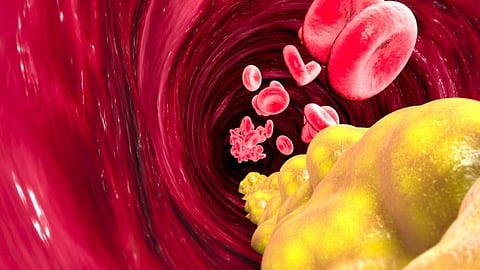 «يصيب الرجال أكثر من النساء».. لا تصدق كل ما يُقال عن الكوليسترول