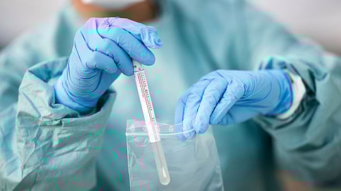 إصابات كورونا حول العالم تتجاوز 238.2 مليون شخص