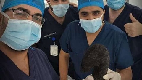 أطباء يُنقذون فتاة بعد ابتلاعها 6 كيلو جرامات من الشعر