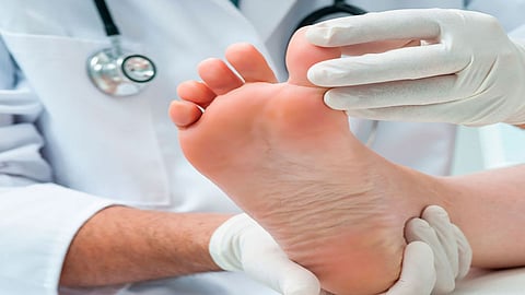 بالفيديو.. استشاري يحذر مرضى القدم السكرية من العلاج الشعبي «يؤدي للبتر»