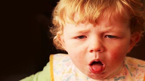 أعراض السعال الديكي لدى الأطفال .. تعرف عليها