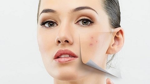 إشارات كهربية لإنتاج الكولاجين.. البلازما الليفية تقنية جديدة لشدّ الوجه