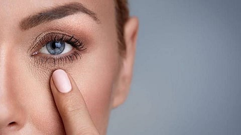 أمراض خطيرة قد تكشف عنها «الهالات السوداء» تحت العين
