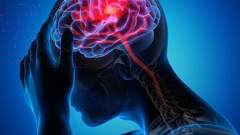 علامات الإصابة بالسكتة الدماغية