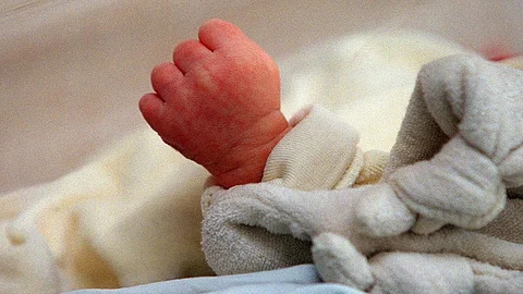 حالة طبية نادرة.. ولادة طفل برازيلي بذيل في نهايته كرة