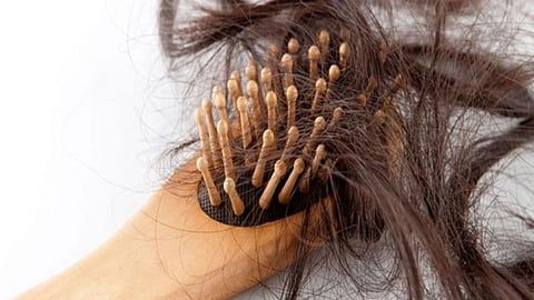 تعرفي على علامة في الشعر تدل على الإصابة بمرض تكيس المبايض