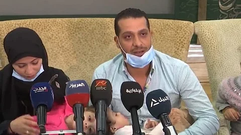 بالفيديو.. أول تعليق من والد التوأم السيامي المصري بعد توجيه خادم الحرمين بعملية الفصل