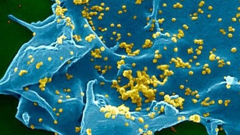 إجراء أول دراسة سريرية بالمملكة عن متلازمة «ميرس»
