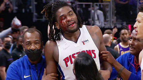 بالفيديو.. ضربة من كوع ليبرون جيمس تحوّل مباراة سلة إلى حلبة قتال شوارع