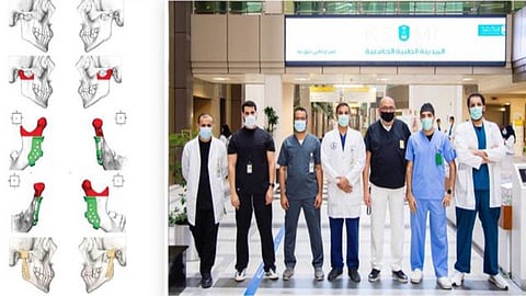 عملية نادرة لاستبدال مفصل الوجه لمريضة بطبية الملك سعود