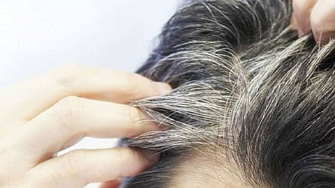 مفاجأة سارة.. 3 خطوات للحد من ظهور الشعر الأبيض