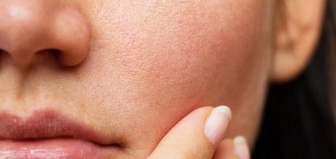 4 نصائح للعناية بالبشرة الجافة في الشتاء