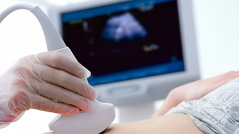 ما أسباب التصاق المشيمة بالرحم؟ استشارية تُجيب