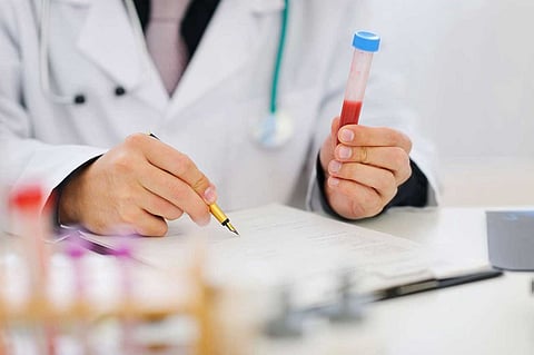 تعرف على أعراض متلازمة «تكيس المبايض» ونتائجها الخطيرة