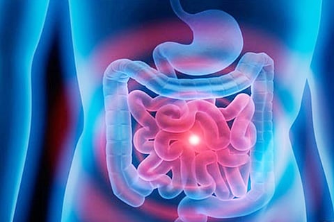 بكتيريا الأمعاء.. مفتاح الرشاقة والبشرة النقية