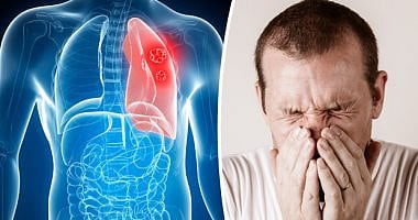 9 أعراض لـ«سرطان الرئة» يجب عليك معرفتها