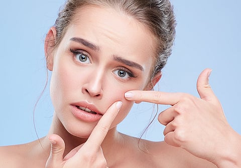 الأطباء يحذرون: استكشاف البثور يهدِّد بشرتم بـ«التندب الدائم»