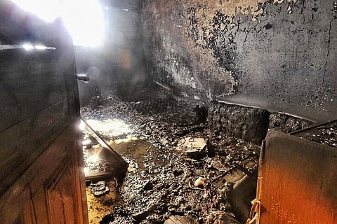 بالصور.. 4 مصابين في حريق منزل بحائل