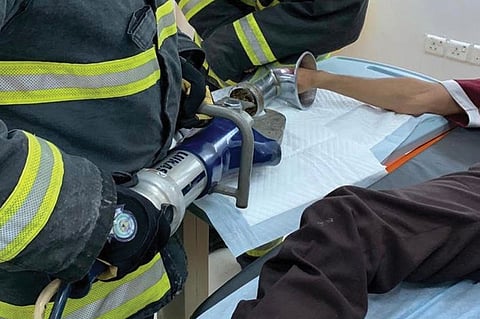 بالصور.. تدخل طبي عاجل ينقذ يد جزار علقت في فرامة لحم بالطائف