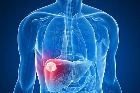 أعراض التهاب الكبد ووسائل الوقاية منه