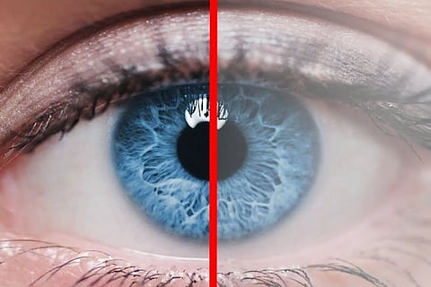 خبراء: «مضادات أكسدة» البديل لجراحة «المياه البيضاء»