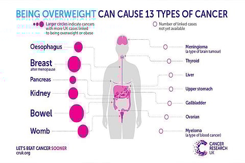 الخضيري: زيادة الوزن ترفع نسبة الإصابة بـ13 نوعًا من السرطان