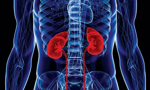 5 أعداء للكلى وتجاهلها ينذر بخطر داهم