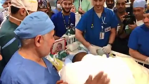 بالفيديو.. لحظة بكاء والدي التوأم السيامي الليبي بعد نجاح عملية فصلهما
