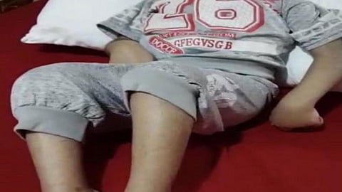 بالفيديو.. نائب أمير جازان يتفاعل مع معاناة الطفلين «وسام» و«إبراهيم»