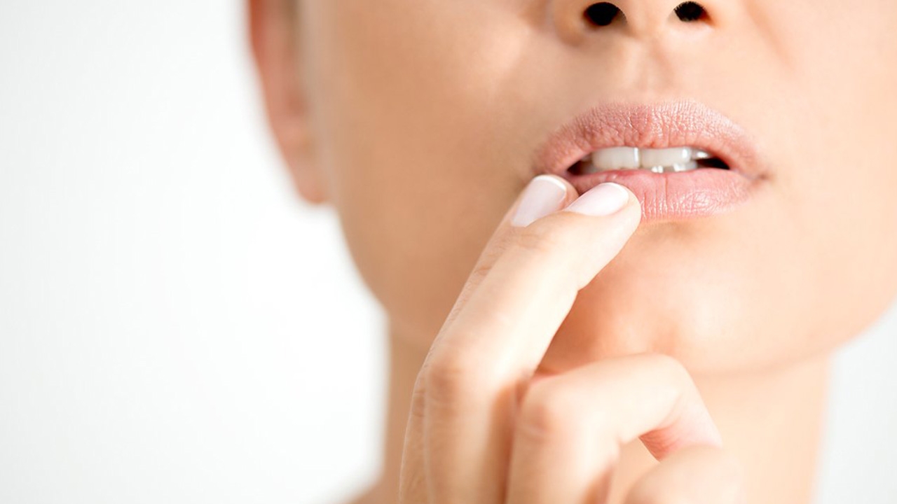 أطباء أمراض جلدية ينصحون بعدم لعق الشفاه المتشققة بالشتاء