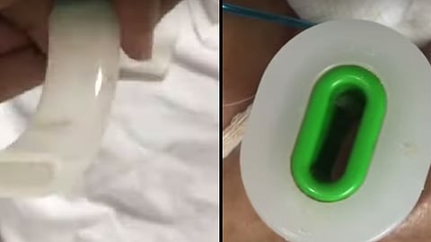 وفاة «مريضة الدود» يدفع ذويها لطلب التحقيق في واقعة «ثغر جدة»