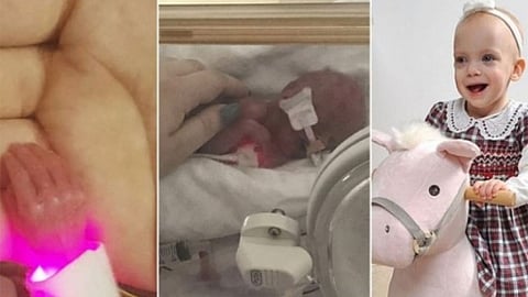 بحالة ولادة مثيرة.. رضيعة تتحدى توقعات الأطباء في بريطانيا