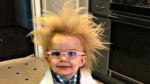 متلازمة الشعر غير المضطربة.. تعرف أعراض وعلاج الحالة النادرة