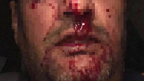 4 شباب يضربون مواطنًا بعنف شديد لتجاوزهم في المرور بمكة