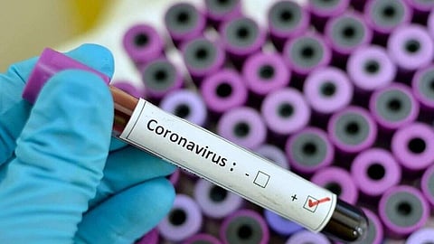 ارتفاع حصيلة الوفيات بفيروس كورونا في إيران إلى 14 شخصًا