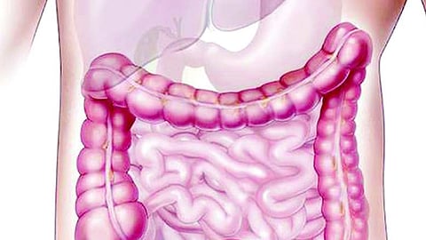 بـ5 خطوات بسيطة.. هكذا تُحسّن أداء «صحة الأمعاء»