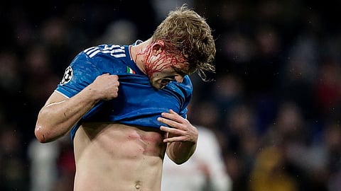 بالفيديو.. دي ليخت يتعرض لإصابة دموية بسبب زميله