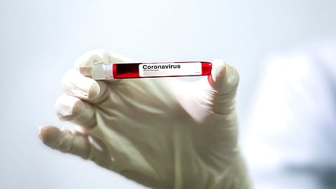 خلال 24 ساعة..  تايلاند تسجل 188 إصابة جديدة بفيروس كورونا